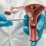 انواع بیماری های زنان که باید مراقب آن ها باشید