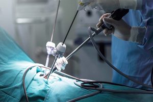 تفاوت لاپاراسکوپی با جراحی باز چیست؟